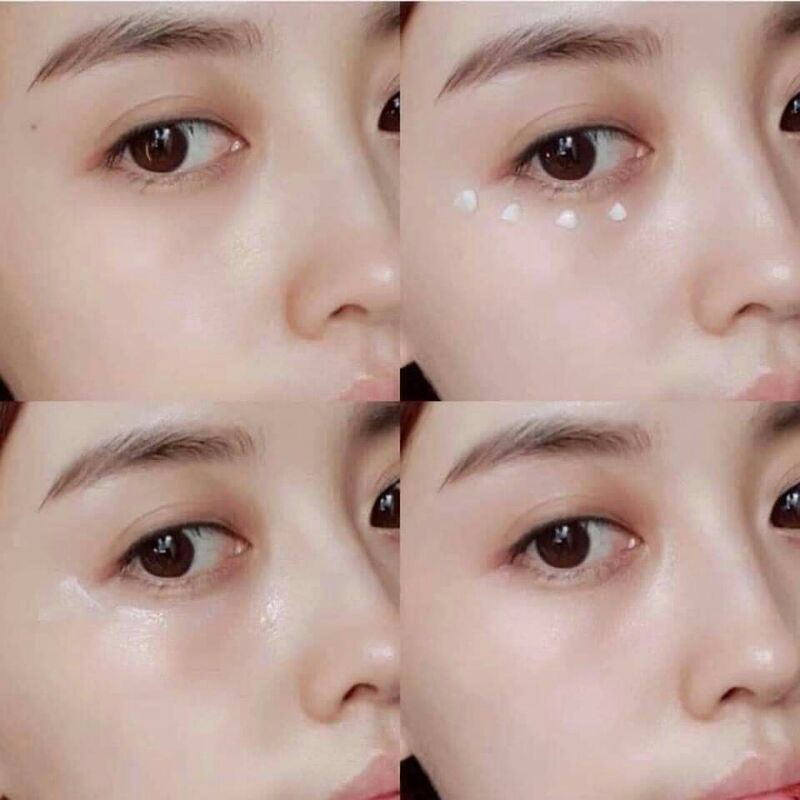 Kem duong mat Charmzone Age Control Eye Cream 10 Kem dưỡng mắt Charmzone Age Control Eye Cream ngày và đêm