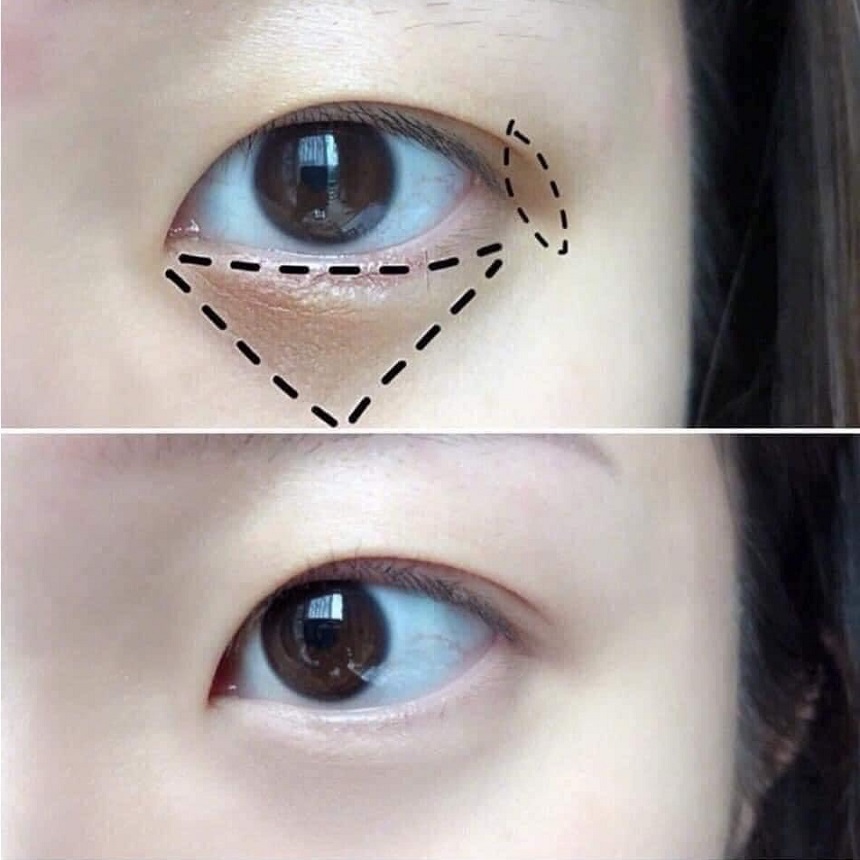 Kem dưỡng mắt Charmzone Top Class Peptider Eye Cream