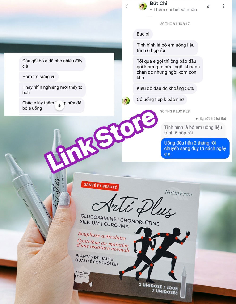Bo xuong khop NatinFran Arti Plus 13 Feedback bo khop NatinFran Arti Plus